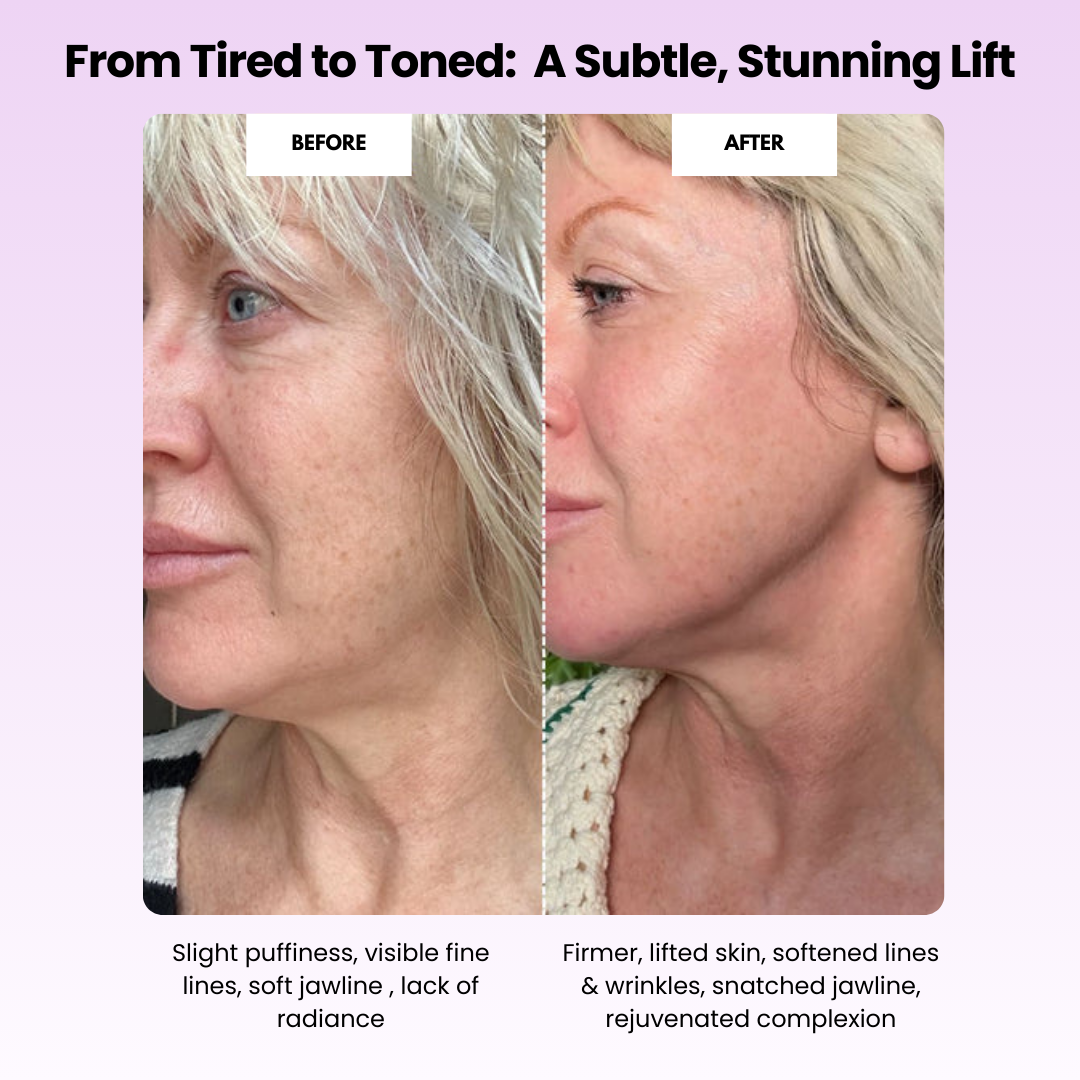 Elarique™ Glow Sculpt - Beauty Roller