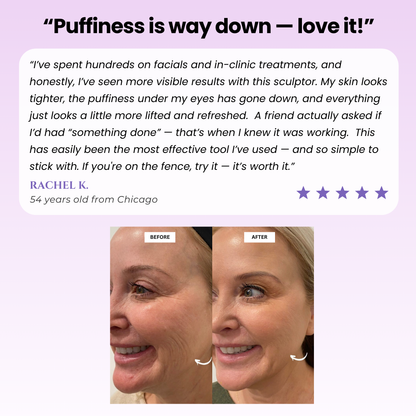 Elarique™ Glow Sculpt - Beauty Roller